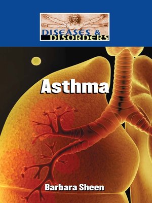 cover image of Asthma